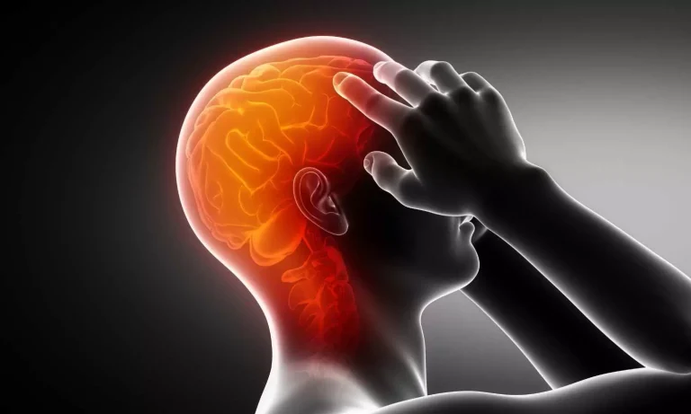 Migraine – What? When? How to Manage?