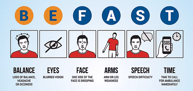 Remember to be fast in stroke